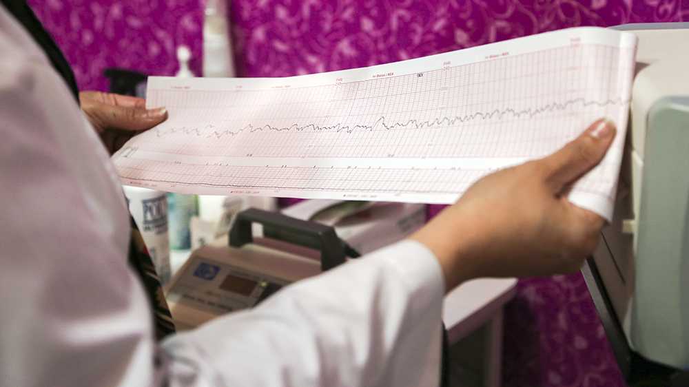 اکوکاردیوگرافی تفاوت اکو و نوار قلب دکتر نادر افشاری متخصص قلب