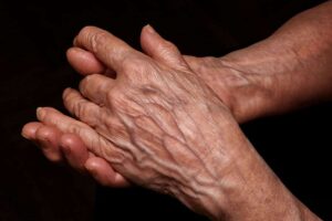 درمان خانگی بیرون زدگی رگهای دست